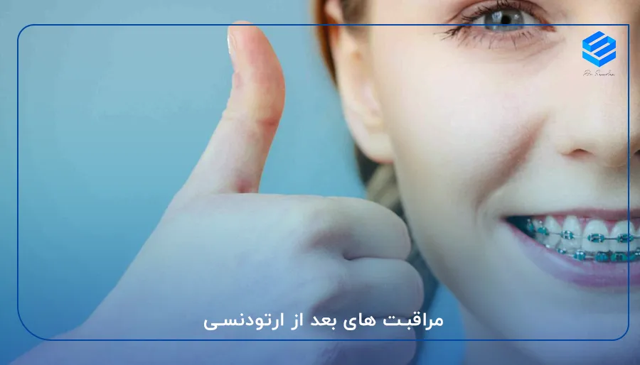 مراقبت های بعد از ارتودنسی