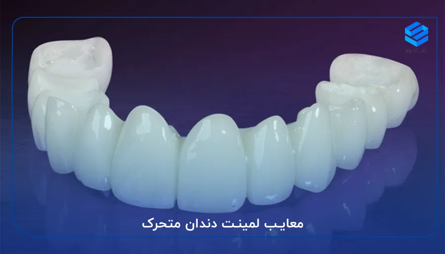 معایب لمینت دندان متحرک