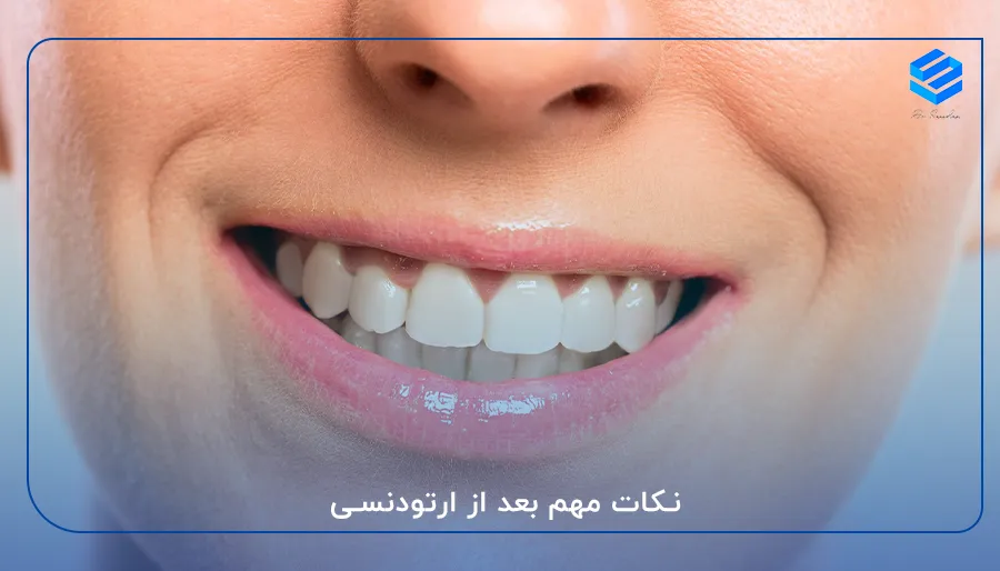 نکات مهم بعد از ارتودنسی