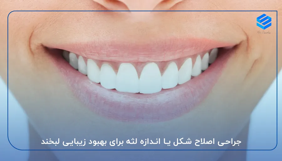 جراحی اصلاح شکل یا اندازه لثه برای بهبود زیبایی لبخند