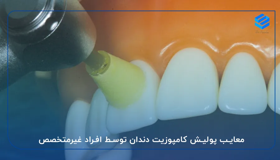 معایب پولیش کامپوزیت دندان توسط افراد غیرمتخصص