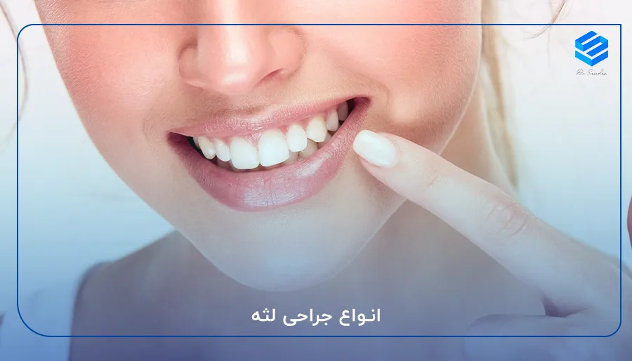 انواع جراحی لثه