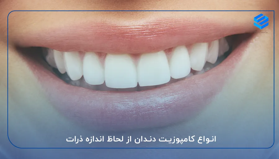 انواع کامپوزیت دندان از لحاظ اندازه ذرات
