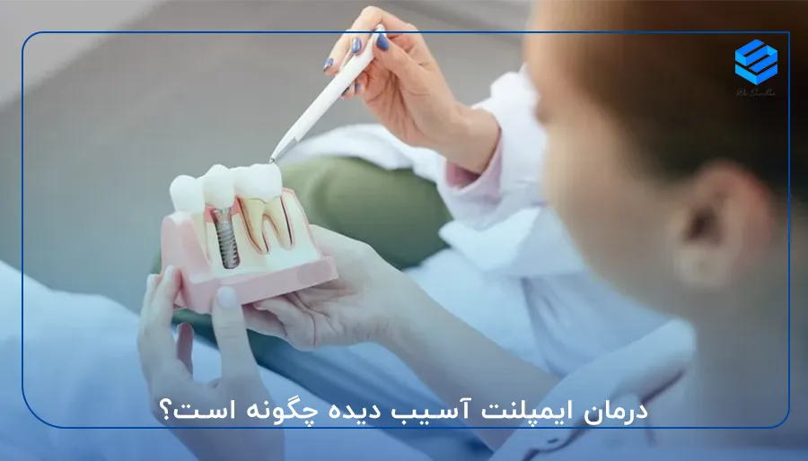 درمان ایمپلنت آسیب دیده چگونه است
