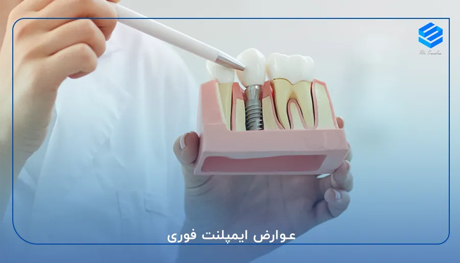 عوارض ایمپلنت فوری