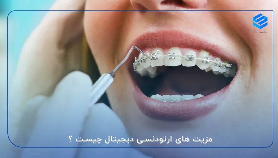 مزیت های ارتودنسی دیجیتال چیست ؟