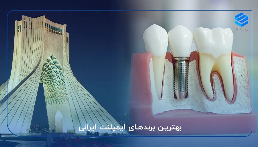 بهترین برندهای ایمپلنت ایرانی