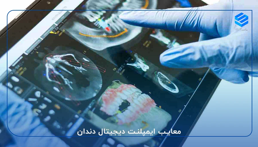 معایب ایمپلنت دیجیتال دندان